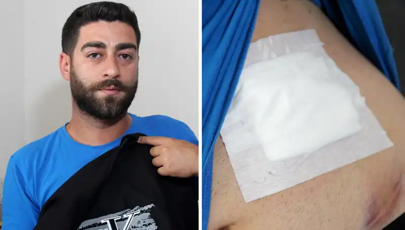 Karnında Ağrı Hissetti, Röntgen Sonucu Şaşırttı!