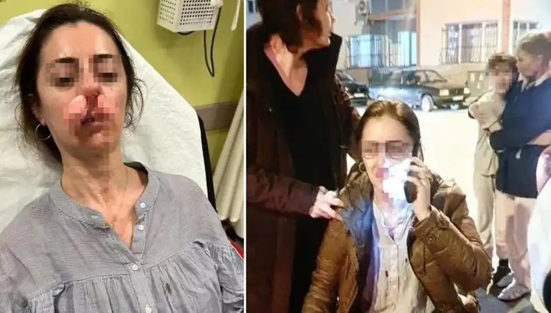 Otomobil Kapısı Silah Sayıldı: İhanet Sandığına Çıldıran Adamın Hikayesi