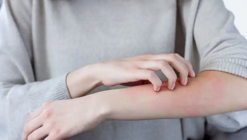 Cilt Kanserinin Alarmı: Dermatologdan İki Gözden Kaçan Belirti Uyarısı