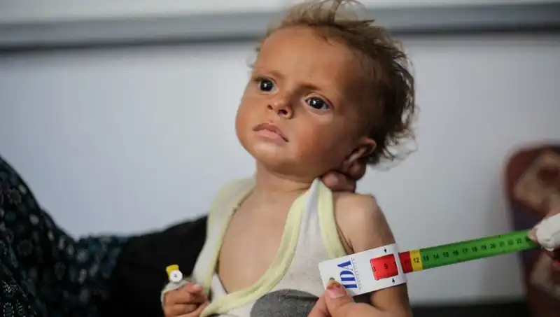 İngiltere, 300 Gazzeli Çocuğa Yeni Bir Yaşam Şansı Sunuyor
