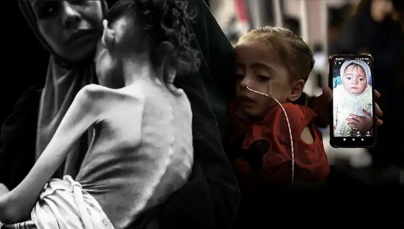 Meryem’in Zorlu Mücadelesi: 25 Kilodan 10 Kiloya Düştü!
