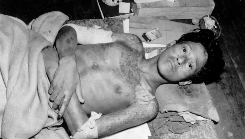 80 Yıl Sonra Nagasaki’den Haykırış: Nükleer Tehlike Yeniden Kapıda!